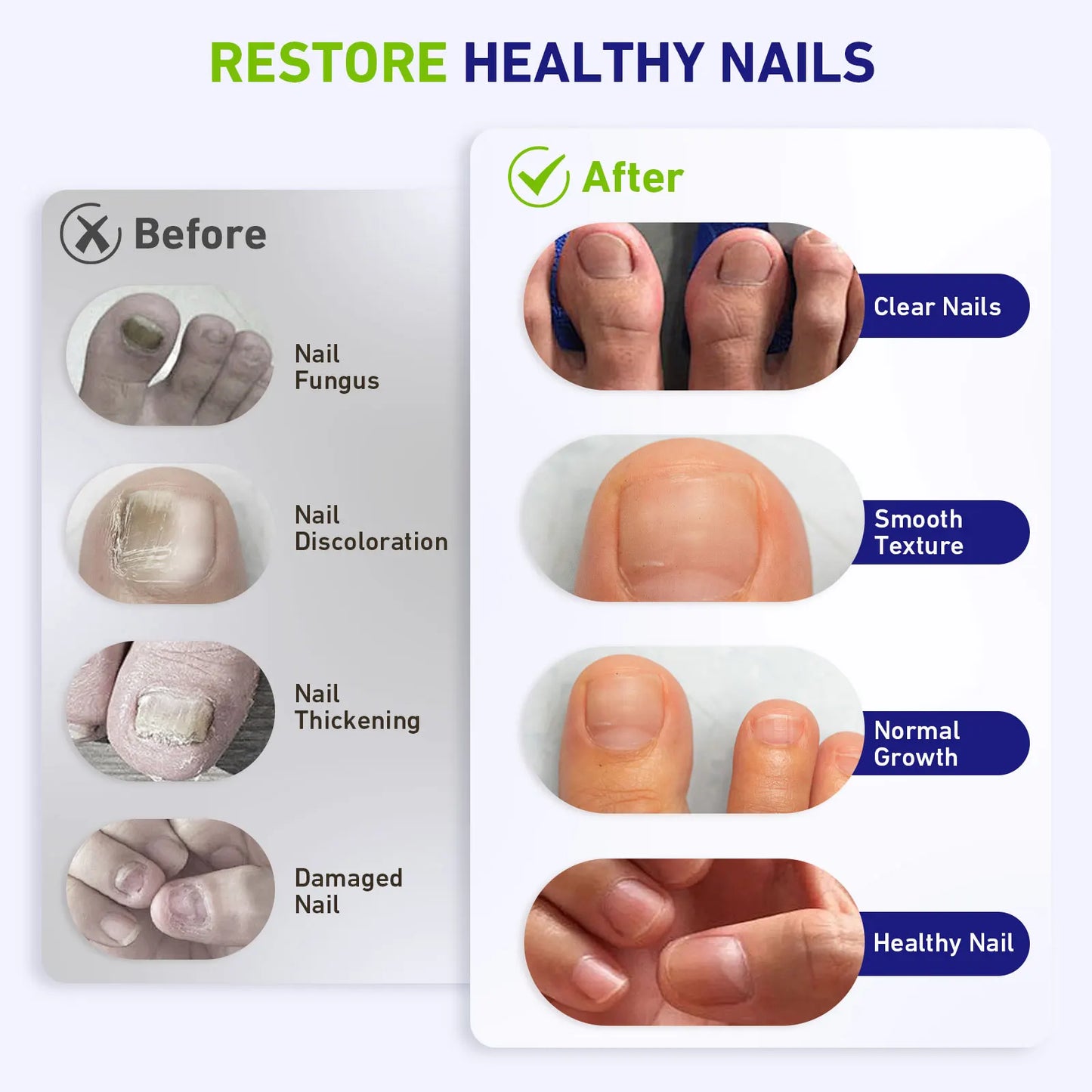 Nail Care LED Light Therapy Device