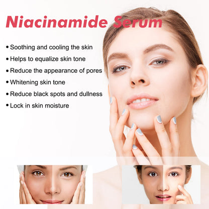 Niacinamide Face Serum – Dark Spot & Fine Line Repair