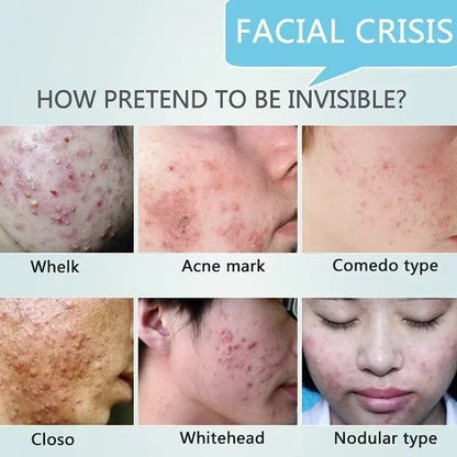 Acne Scar & Pore Repair Cream