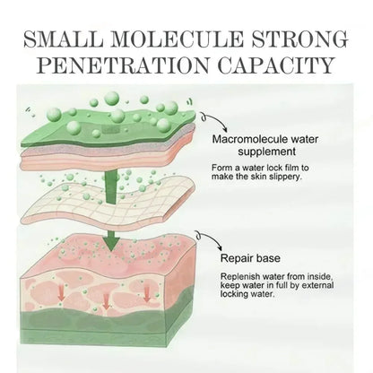 Acne Care Cream – Men & Women Skin Treatment