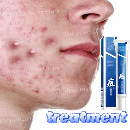 Acne Scar & Pore Repair Cream