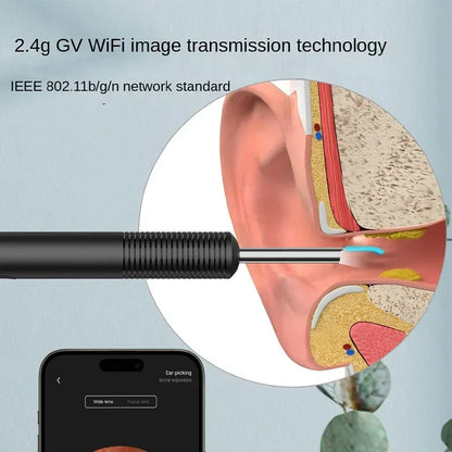 Wireless WiFi Ear Cleaning Camera