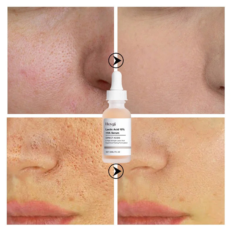 Lactic Acid Pore Refining Serum