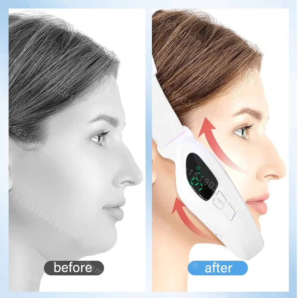 Face Lifting & Double Chin Remover EMS Massager