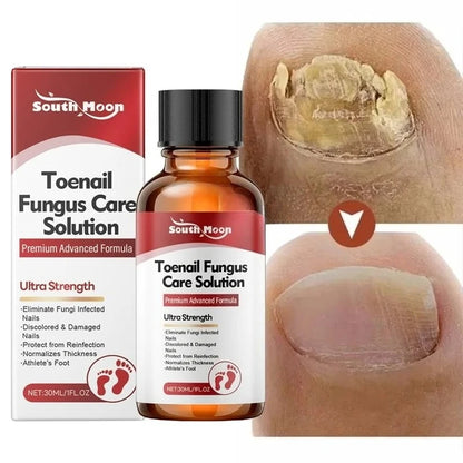 Anti-Fungus Nail Serum