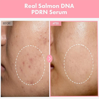 PDRN Peptide Complex Serum