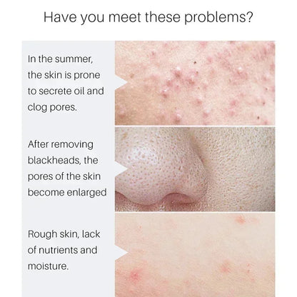 Lactic Acid Pore Refining Serum