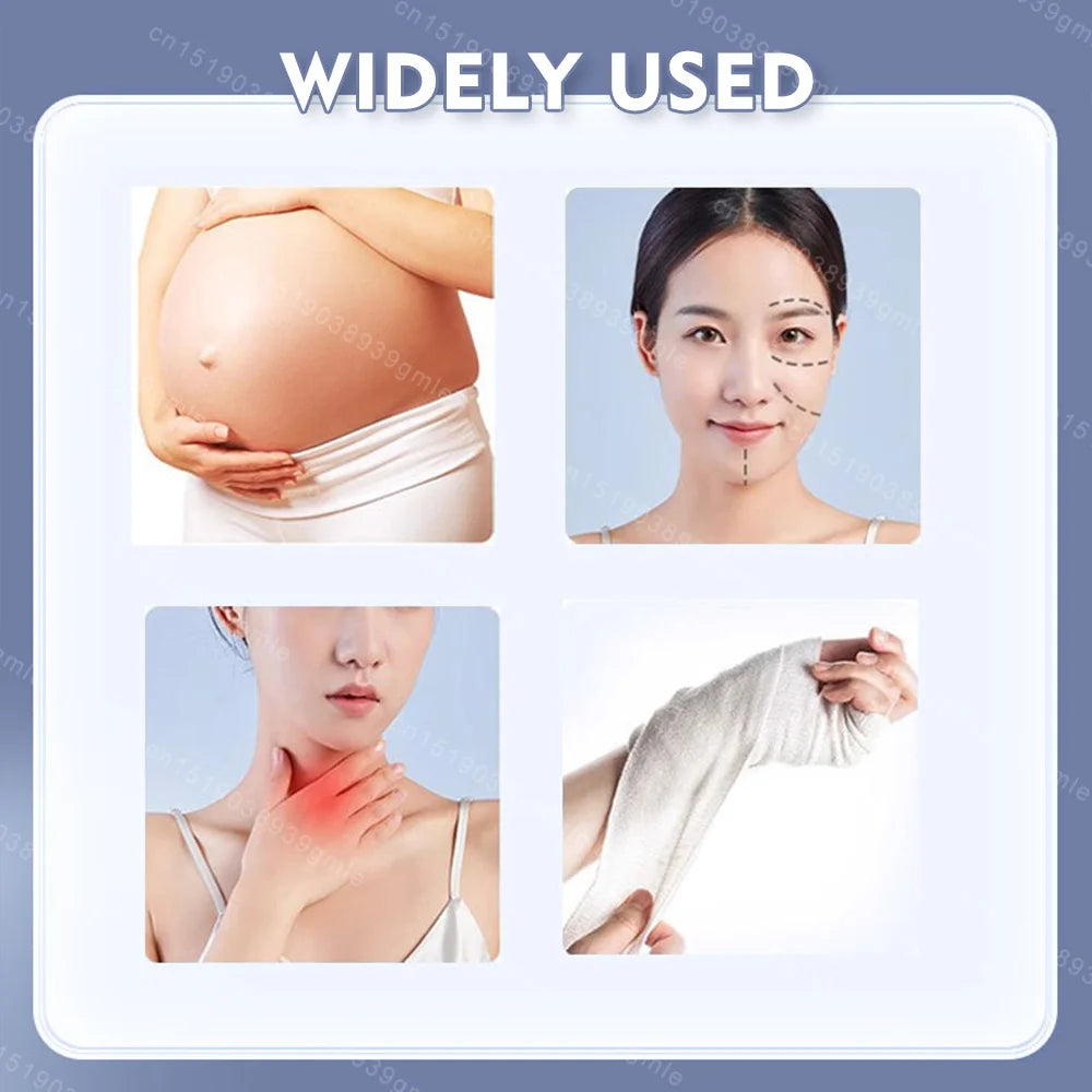 Scar Repair Silicone Patch – Self-Adhesive Therapy