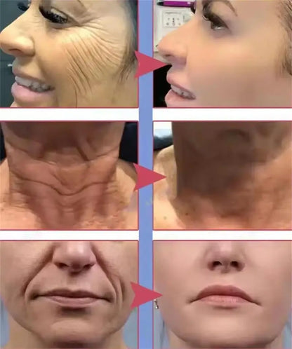 Retinol Collagen Anti-Wrinkle Cream