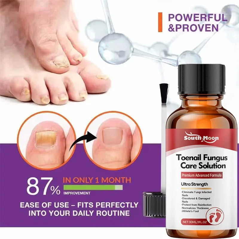 Anti-Fungus Nail Serum