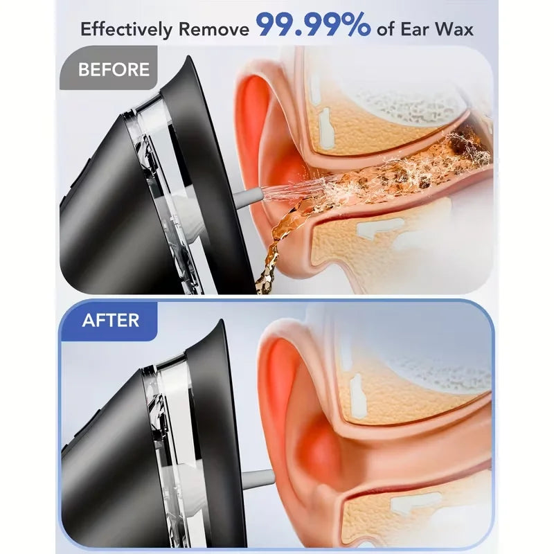 Electric Ear Cleaning Kit with LED Display