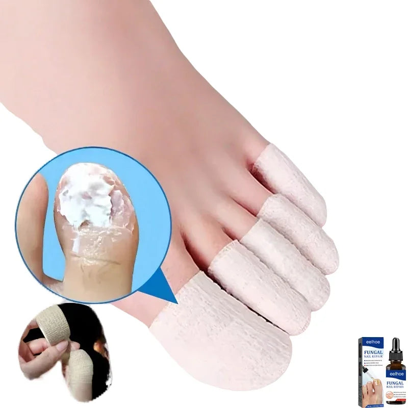 Fungal Nail Treatment & Protection Set