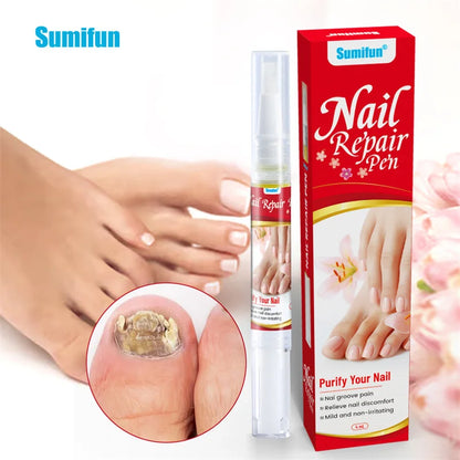Anti-Fungus Nail Serum