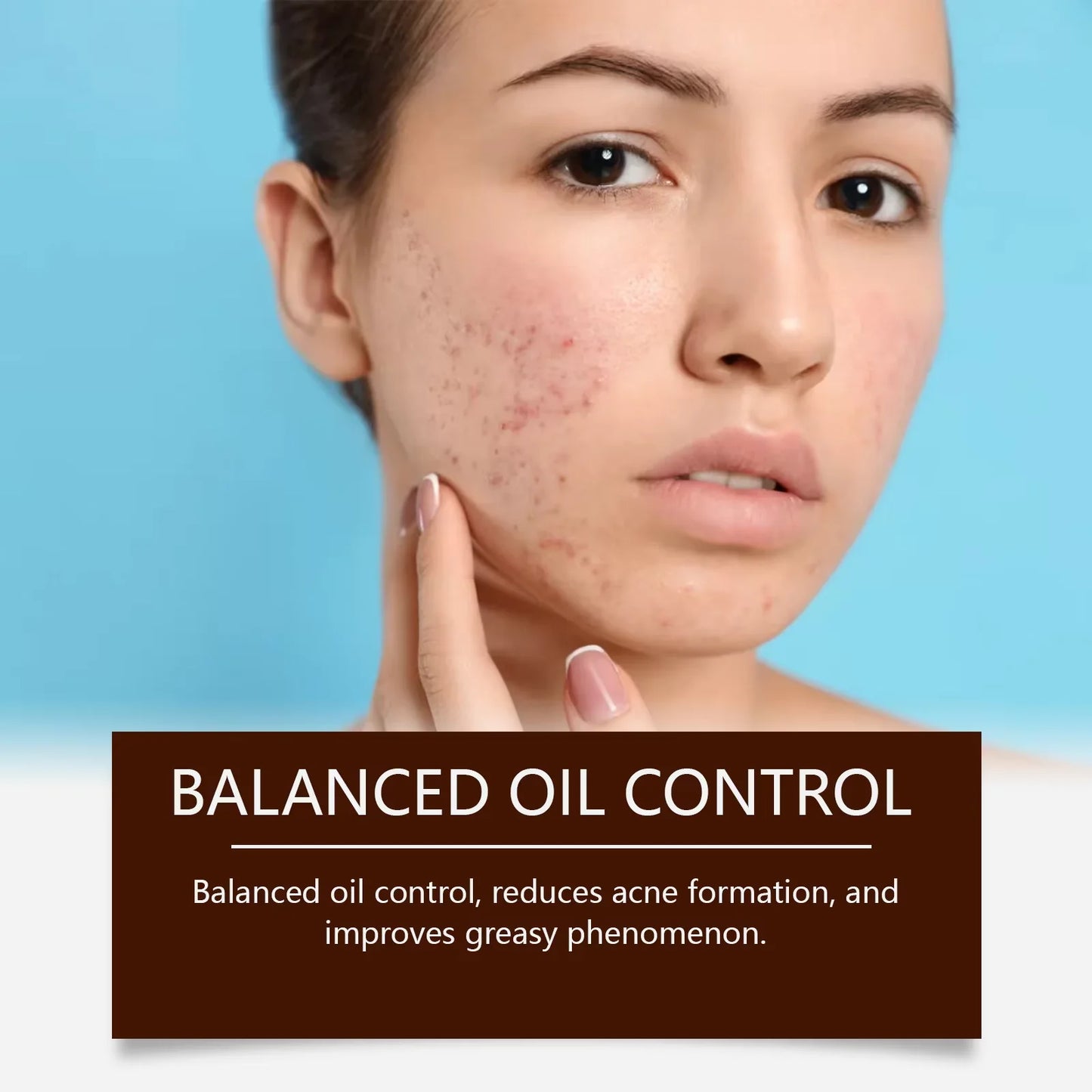 Acne Scar & Pore Repair Cream