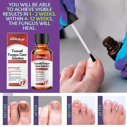Anti-Fungus Nail Serum